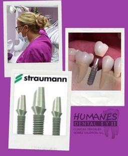 Humanes Dental implantes dentales